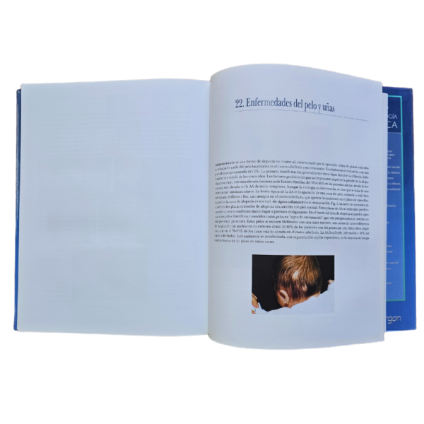 ATLAS DE DERMATOLOGIA PEDIATRICA 1 TOMO - Image 2