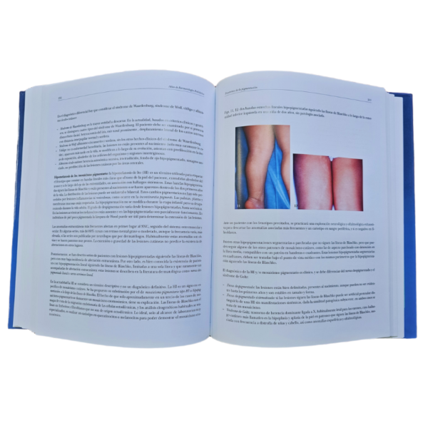 ATLAS DE DERMATOLOGIA PEDIATRICA 1 TOMO - Image 4